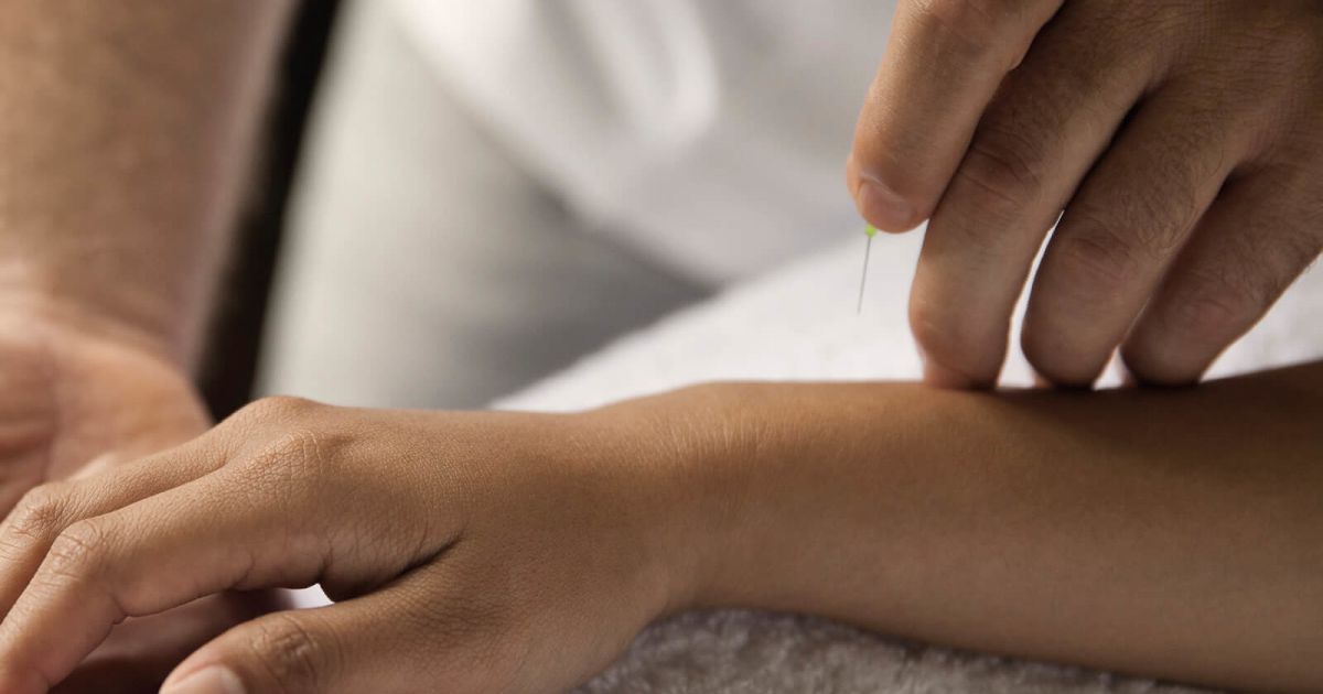 Acupuncture Wellness at COMO Metropolitan London